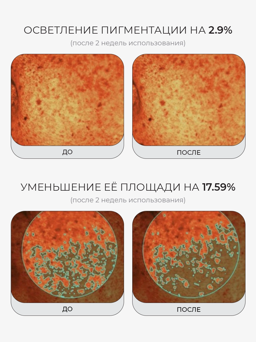 Сыворотка с микроиглами ПДРН и экзосомами Medicube — фото 3